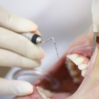 Periodontia Mobile